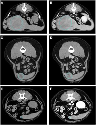 A Machine Learning-Based Approach for Classification of Focal Splenic Lesions Based on Their CT Features